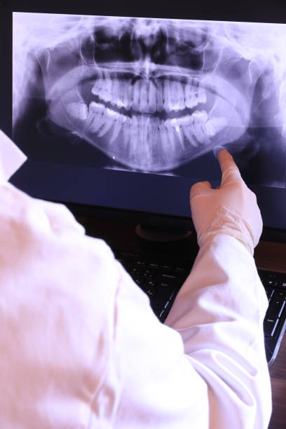 Best Knocked-Out Tooth Emergency  in Clementon, NJ